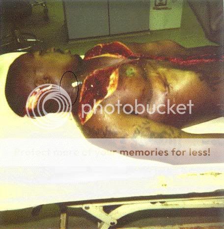 Tupac+autopsy+pic